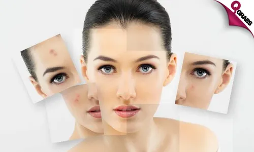 Acne Treatment & Care Online Course!